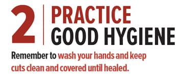 2 Practice Good Hygiene Remember to wash your hands and keep cuts clean and covered until healed.